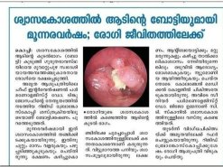 Pulmonologist in kochi